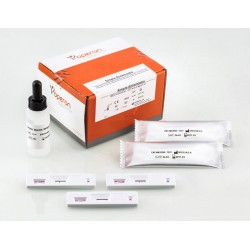 Tests rapides Entamoeba.Test immunochromatograp...